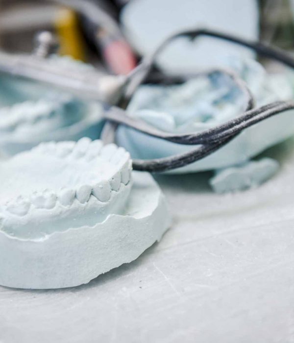 Dental Impressions | Key Prosthodontics | Calgary and Surrounding Area | Prosthodontic Specialist