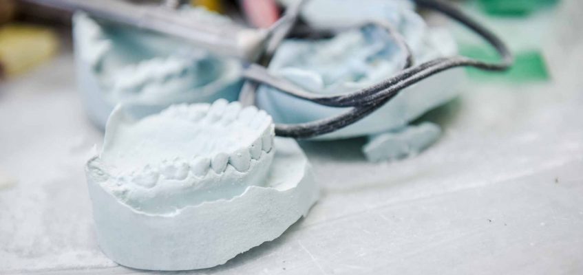 Dental Impressions | Key Prosthodontics | Calgary and Surrounding Area | Prosthodontic Specialist