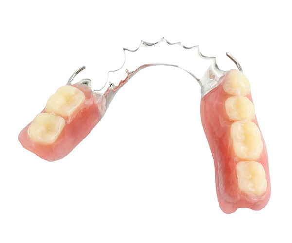 Partial Dentures SW Calgary | Key Prosthodontics | Prosthodontist SW Calgary AB