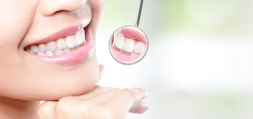 Calgary Teeth Whitening Prosthodontics | Key Prosthodontic | Calgary AB